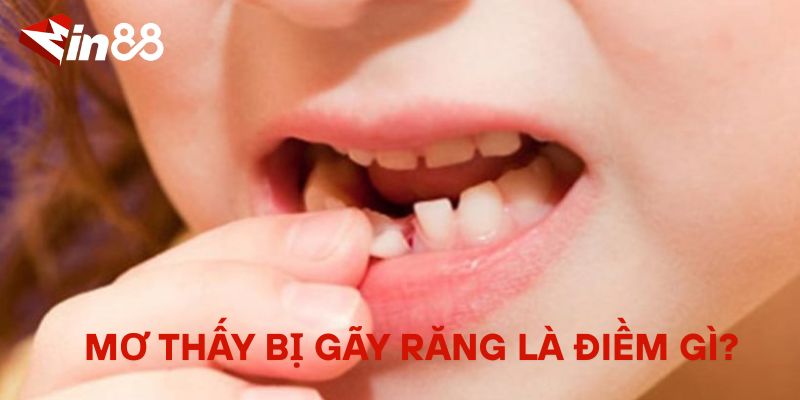 Mơ Bị Gãy Răng Đánh Con Gì? Giải Mã Giấc Mơ Gãy Răng Mơ thấy bị gãy răng là điềm gì?