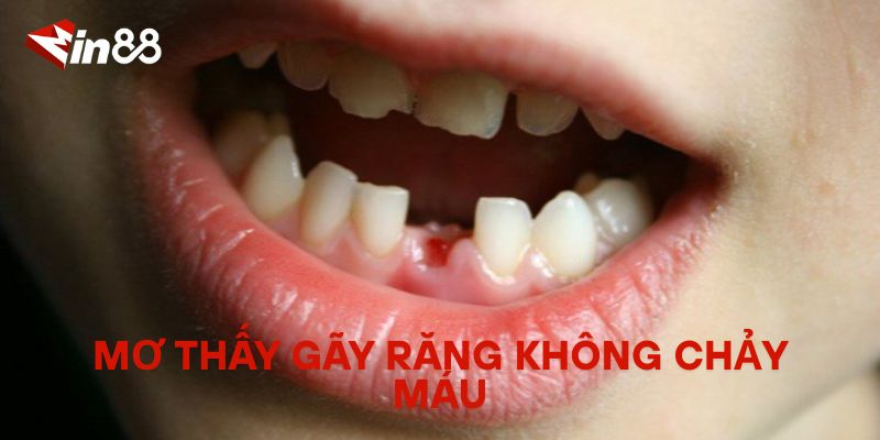 Mơ Bị Gãy Răng Đánh Con Gì? Giải Mã Giấc Mơ Gãy Răng Mơ thấy gãy răng không chảy máu