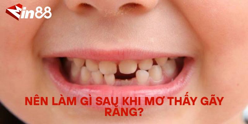 Mơ Bị Gãy Răng Đánh Con Gì? Giải Mã Giấc Mơ Gãy Răng Nên làm gì sau khi mơ thấy gãy răng?
